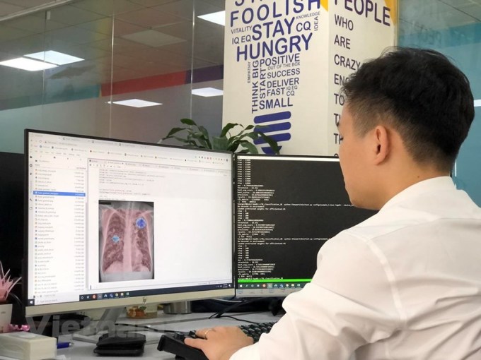 VinBrain đưa công nghệ chẩn đoán hình ảnh bằng AI đến Myanmar